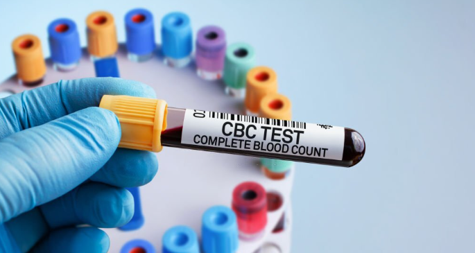 cbc test price in bangladesh