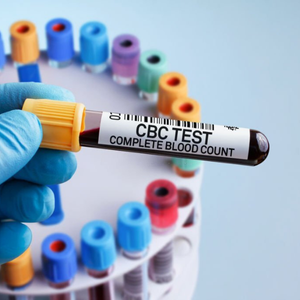 cbc test price in bangladesh